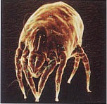 dust mite allergies, dust mites, common house dust mite, common allergy, human skin scales, airborne allergens, air pollutants, HEPA filtrations, medical grade HEPA filter, HEPA-equipped vacuum cleaner, high efficiency particulate air, pollen, pet dander, air purification systems